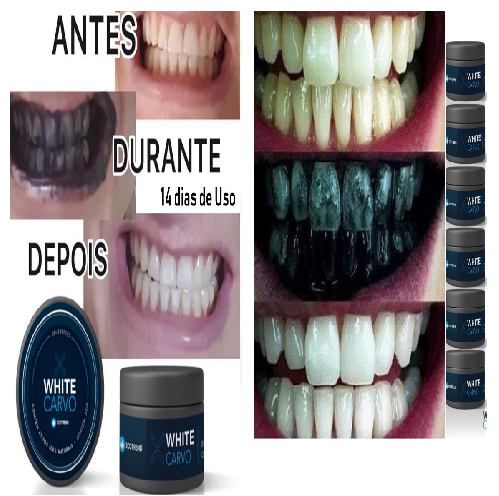 Clareador Dental Natural Carvão Ativado White Carvo